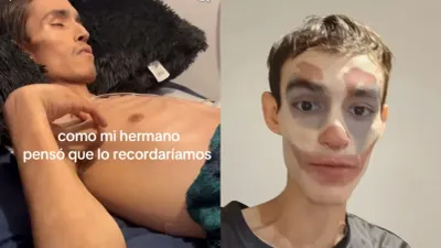 Fallece Miguel Juárez, joven chihuahuense que documentó su cáncer en TikTok