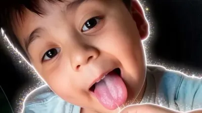 Piden ayuda para Leonel, niño de 4 años con cáncer de oído