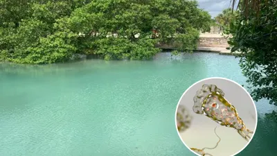 Restringen acceso a seis lagos de Mérida por ameba comecerebros