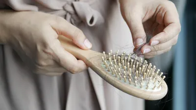 ¿Se te cae el cabello? Conoce las causas y cuándo acudir al médico