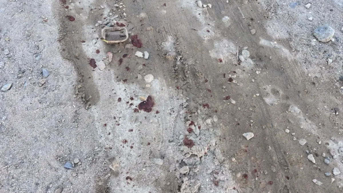 Balean a mujer dentro de vivienda en Vistas de Zaragoza