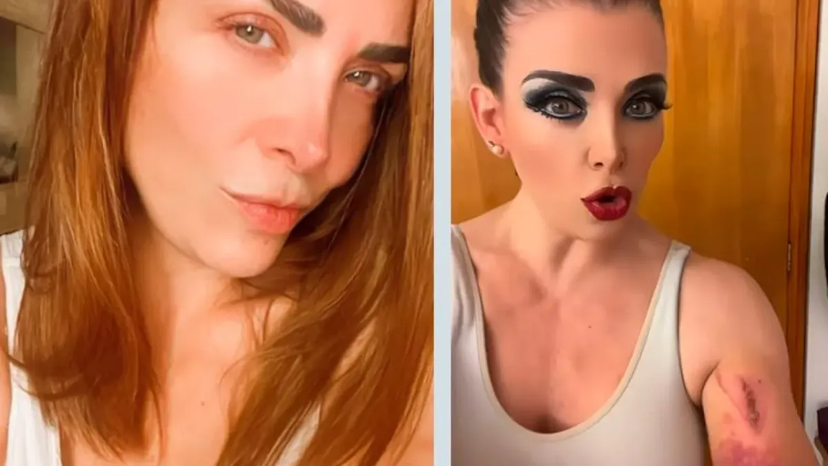 Sufre Lisset aparatosa caída en una coladera