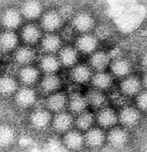 Detectan cepa transmisible entre humanos en brote de hantavirus