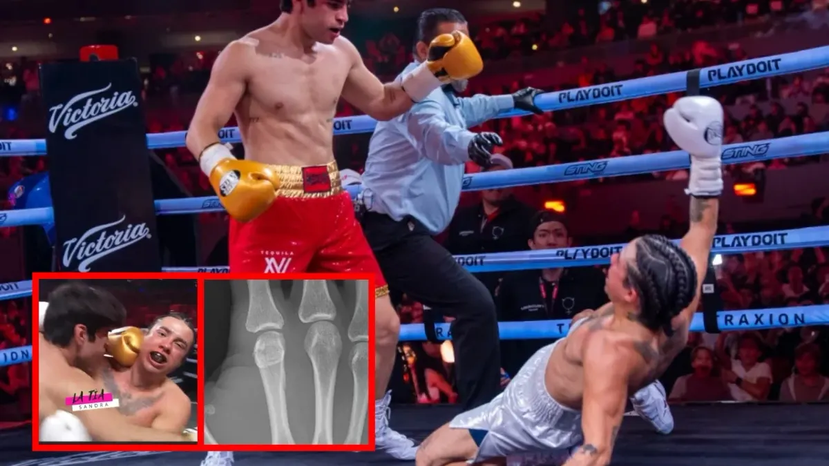 Terminó Mario Bautista en el hospital tras nocaut en Supernova