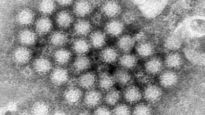 Detectan cepa transmisible entre humanos en brote de hantavirus