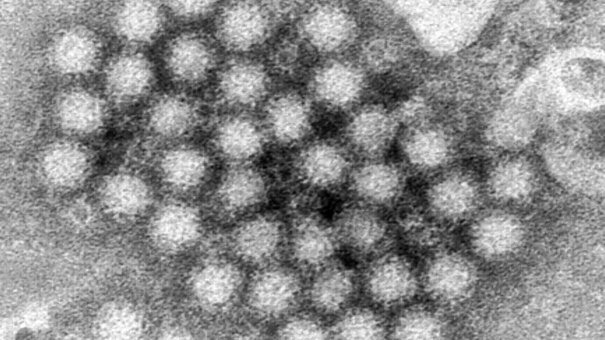 Brote de hantavirus enciende alerta sanitaria; Esto es lo que debes saber